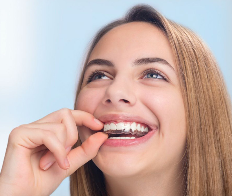 Patient holding a clear aligner near her teeth